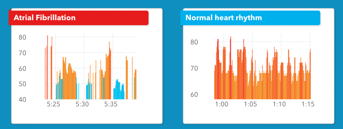 Cardiogram best sale apple watch